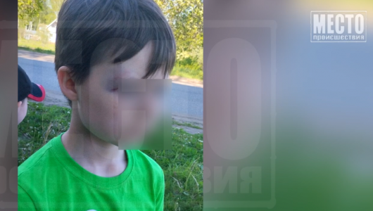 Избил 8-летнего мальчика в Пасегово