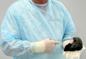 Хирурги в Кирове удалили огромный комок волос из желудка ребенка